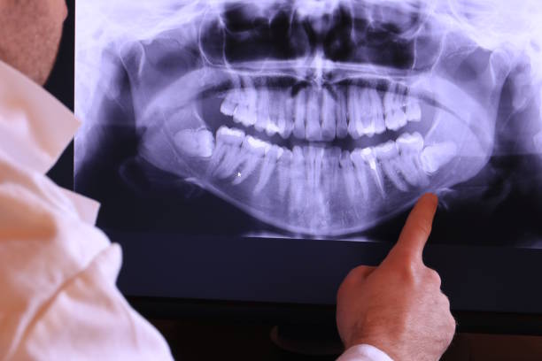 Emergency Dental Filling Replacement in WI